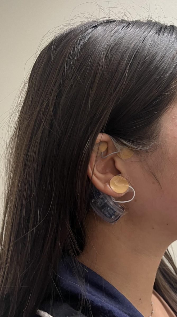 Freshman Flora Nishigawara wears a shocker on her ear to help with headaches caused by concussions.